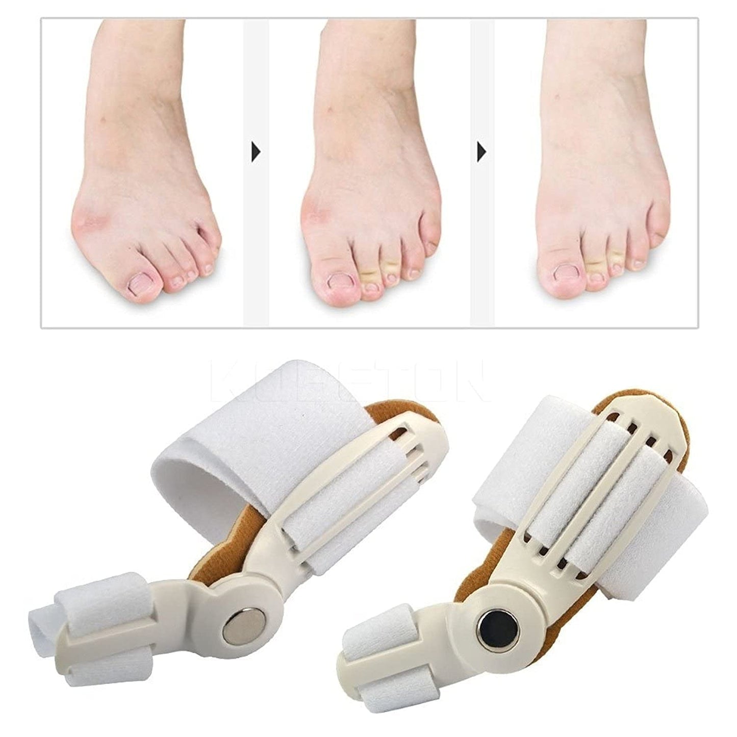 Toe Thumb straightener corrector