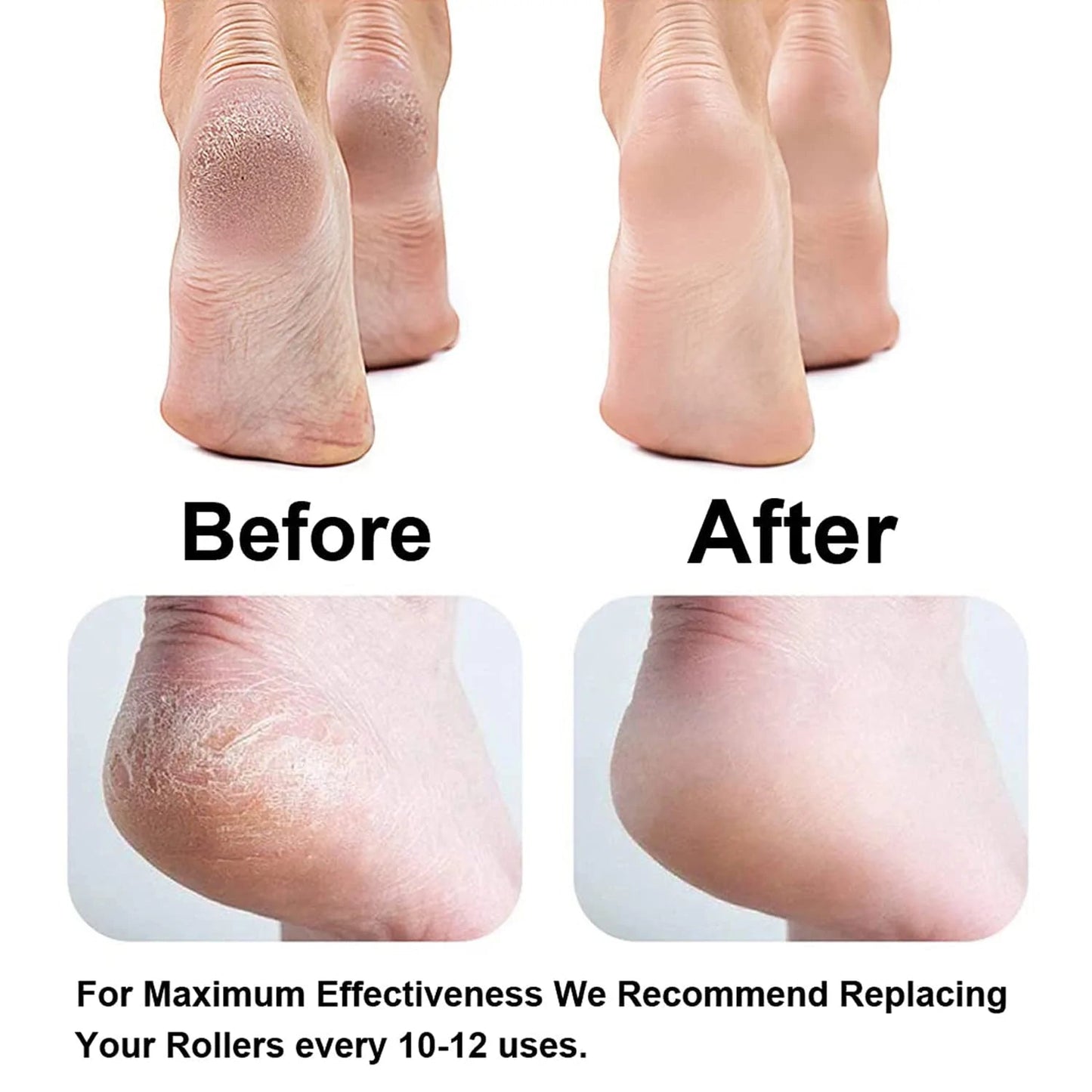 PediLux™  Rechargeable Callus & Dead Skin Remover