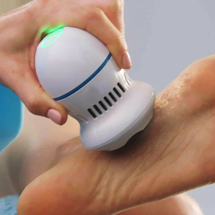 Electric Callus Remover with Vacuum