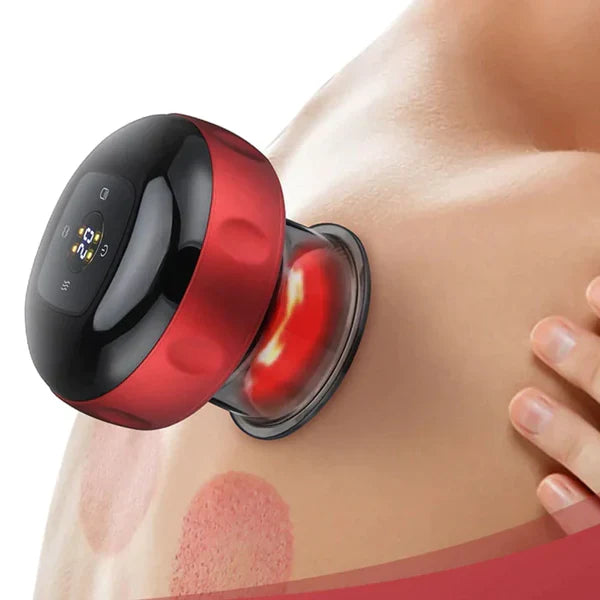 PowerGrip™ Cupping Device